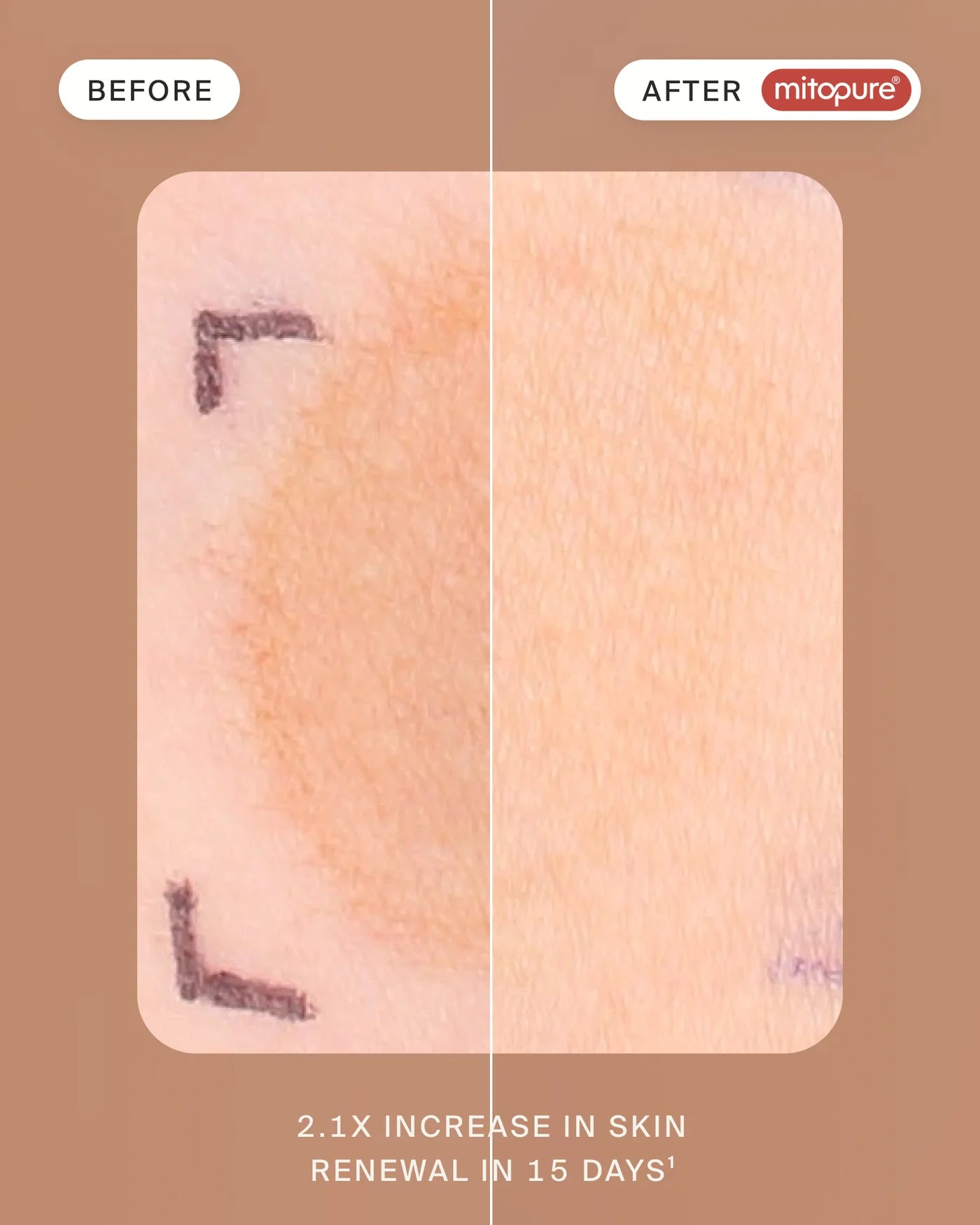 Mitopure Resurfacing Exfoliator Mini